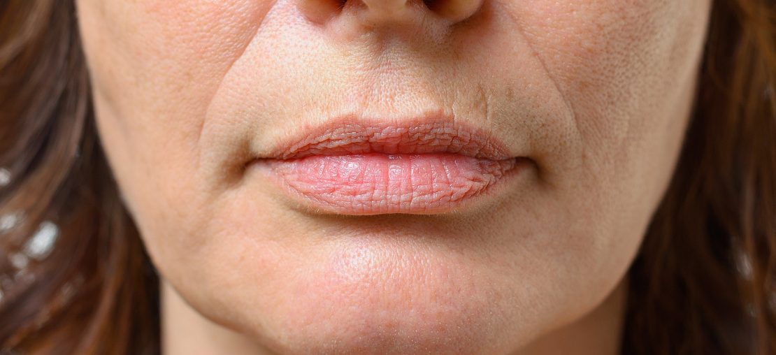 O que causa a perda de volume facial? Veja 5 fatores